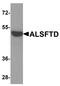 C9orf72-SMCR8 Complex Subunit antibody, TA355014, Origene, Western Blot image 