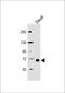 RELB Proto-Oncogene, NF-KB Subunit antibody, M00836-2, Boster Biological Technology, Western Blot image 