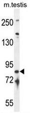 Intraflagellar Transport 81 antibody, AP52160PU-N, Origene, Western Blot image 