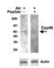 Cholesterol 24-hydroxylase antibody, PA3-16810, Invitrogen Antibodies, Western Blot image 