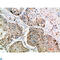 Lysosome-associated membrane glycoprotein 3 antibody, LS-C813832, Lifespan Biosciences, Immunohistochemistry paraffin image 