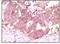 Fibroblast Growth Factor 2 antibody, M00121-1, Boster Biological Technology, Immunohistochemistry paraffin image 