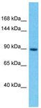 Immunoglobulin Superfamily Member 22 antibody, TA337352, Origene, Western Blot image 