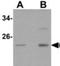 Calcium-binding protein 7 antibody, NBP1-77191, Novus Biologicals, Western Blot image 