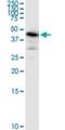 Armadillo Repeat Containing 6 antibody, H00093436-M03, Novus Biologicals, Western Blot image 