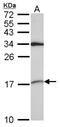 Small Nuclear Ribonucleoprotein D2 Polypeptide antibody, NBP2-20438, Novus Biologicals, Western Blot image 