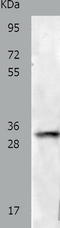 hVDAC1 antibody, TA322858, Origene, Western Blot image 