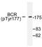 Renal carcinoma antigen NY-REN-26 antibody, AP01539PU-N, Origene, Western Blot image 