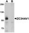 Zinc Finger CCCH-Type Containing, Antiviral 1 antibody, orb75457, Biorbyt, Western Blot image 