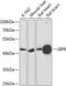 Gastric Inhibitory Polypeptide Receptor antibody, 23-919, ProSci, Western Blot image 