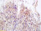 MHC Class I Polypeptide-Related Sequence B antibody, GTX60191, GeneTex, Immunohistochemistry paraffin image 