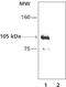 Histone Deacetylase 7 antibody, NB100-2146, Novus Biologicals, Immunoprecipitation image 