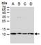 Small Nuclear Ribonucleoprotein Polypeptide E antibody, NBP2-43792, Novus Biologicals, Western Blot image 