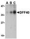 DNA Fragmentation Factor Subunit Beta antibody, orb74382, Biorbyt, Western Blot image 