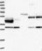 ADP Ribosylation Factor Like GTPase 13A antibody, NBP1-90844, Novus Biologicals, Western Blot image 