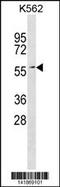 ETS2 Repressor Factor antibody, 60-799, ProSci, Western Blot image 