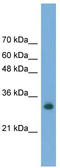 Family With Sequence Similarity 78 Member A antibody, TA333583, Origene, Western Blot image 