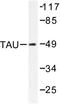 PHF-tau antibody, AP06342PU-N, Origene, Western Blot image 