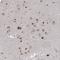 Alkylglycerone Phosphate Synthase antibody, HPA030209, Atlas Antibodies, Immunohistochemistry frozen image 