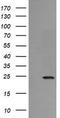 RAB21, Member RAS Oncogene Family antibody, TA505741, Origene, Western Blot image 