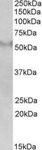Fibronectin Type III And SPRY Domain Containing 1 antibody, GTX89413, GeneTex, Western Blot image 