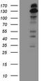 Insulin Receptor Substrate 1 antibody, TA808550S, Origene, Western Blot image 