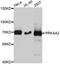 Protein Kinase AMP-Activated Catalytic Subunit Alpha 2 antibody, A0792, ABclonal Technology, Western Blot image 