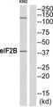 Eukaryotic translation initiation factor 2 subunit 2 antibody, TA314831, Origene, Western Blot image 