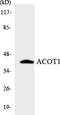 Acyl-CoA Thioesterase 1 antibody, LS-C200078, Lifespan Biosciences, Western Blot image 