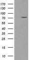 Peptidyl Arginine Deiminase 4 antibody, TA504791BM, Origene, Western Blot image 