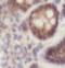 Rho Associated Coiled-Coil Containing Protein Kinase 2 antibody, FNab07379, FineTest, Immunohistochemistry paraffin image 