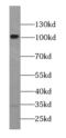 Catenin alpha-2 antibody, FNab00331, FineTest, Western Blot image 