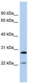 Fibrinogen Beta Chain antibody, TA346396, Origene, Western Blot image 