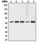 Tumor Protein P63 antibody, LS-C353073, Lifespan Biosciences, Western Blot image 