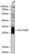 Major Histocompatibility Complex, Class II, DQ Beta 2 antibody, 14-064, ProSci, Western Blot image 