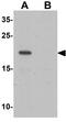 LEM Domain Containing 1 antibody, GTX16303, GeneTex, Western Blot image 