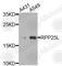 Ribonuclease P/MRP Subunit P25 Like antibody, A9889, ABclonal Technology, Western Blot image 