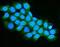 Succinyl-CoA:3-ketoacid-coenzyme A transferase 1, mitochondrial antibody, A07229-1, Boster Biological Technology, Immunofluorescence image 
