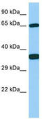 Polypeptide N-Acetylgalactosaminyltransferase 13 antibody, TA342073, Origene, Western Blot image 