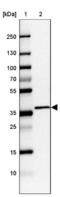 Chromosome 2 Open Reading Frame 72 antibody, NBP1-93551, Novus Biologicals, Western Blot image 