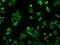 Protein Phosphatase 5 Catalytic Subunit antibody, MA5-24963, Invitrogen Antibodies, Immunocytochemistry image 
