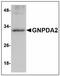 Glucosamine-6-Phosphate Deaminase 2 antibody, AP23863PU-N, Origene, Western Blot image 