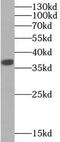 Lactate Dehydrogenase A antibody, FNab04737, FineTest, Western Blot image 
