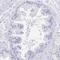 Tctex1 Domain Containing 4 antibody, NBP2-32366, Novus Biologicals, Immunohistochemistry paraffin image 
