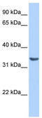 RAB40A, Member RAS Oncogene Family antibody, TA340254, Origene, Western Blot image 