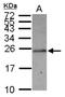 Solute Carrier Family 22 Member 18 Antisense antibody, NBP2-15120, Novus Biologicals, Western Blot image 