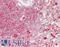 Ribosomal Protein S3 antibody, LS-B14188, Lifespan Biosciences, Immunohistochemistry paraffin image 