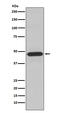 Neutrophil Cytosolic Factor 1 antibody, M01586, Boster Biological Technology, Western Blot image 