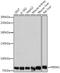FRAS1 Related Extracellular Matrix 1 antibody, A09605-1, Boster Biological Technology, Western Blot image 