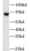 TATA-Box Binding Protein Associated Factor 5 Like antibody, FNab08486, FineTest, Western Blot image 